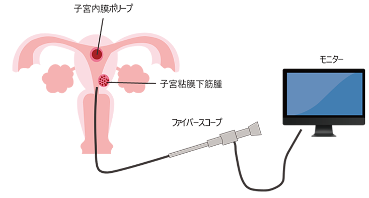新しい病院での検査